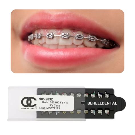 bracket metal orthoclasic gigi|Orthodontic Brackets .